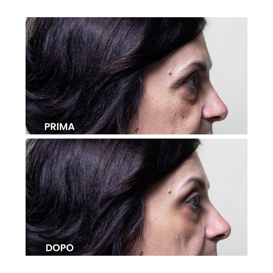 axover istante lifting effect serum